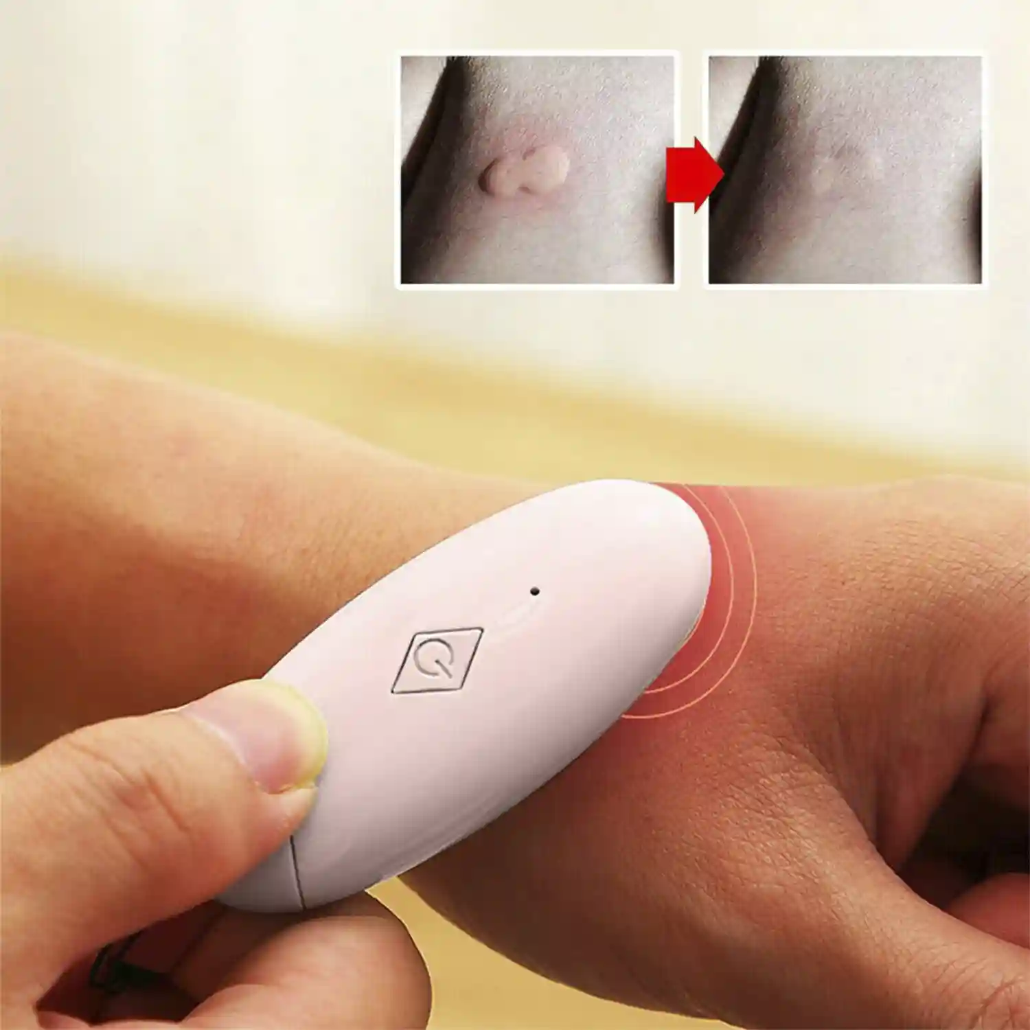 Product Thumb