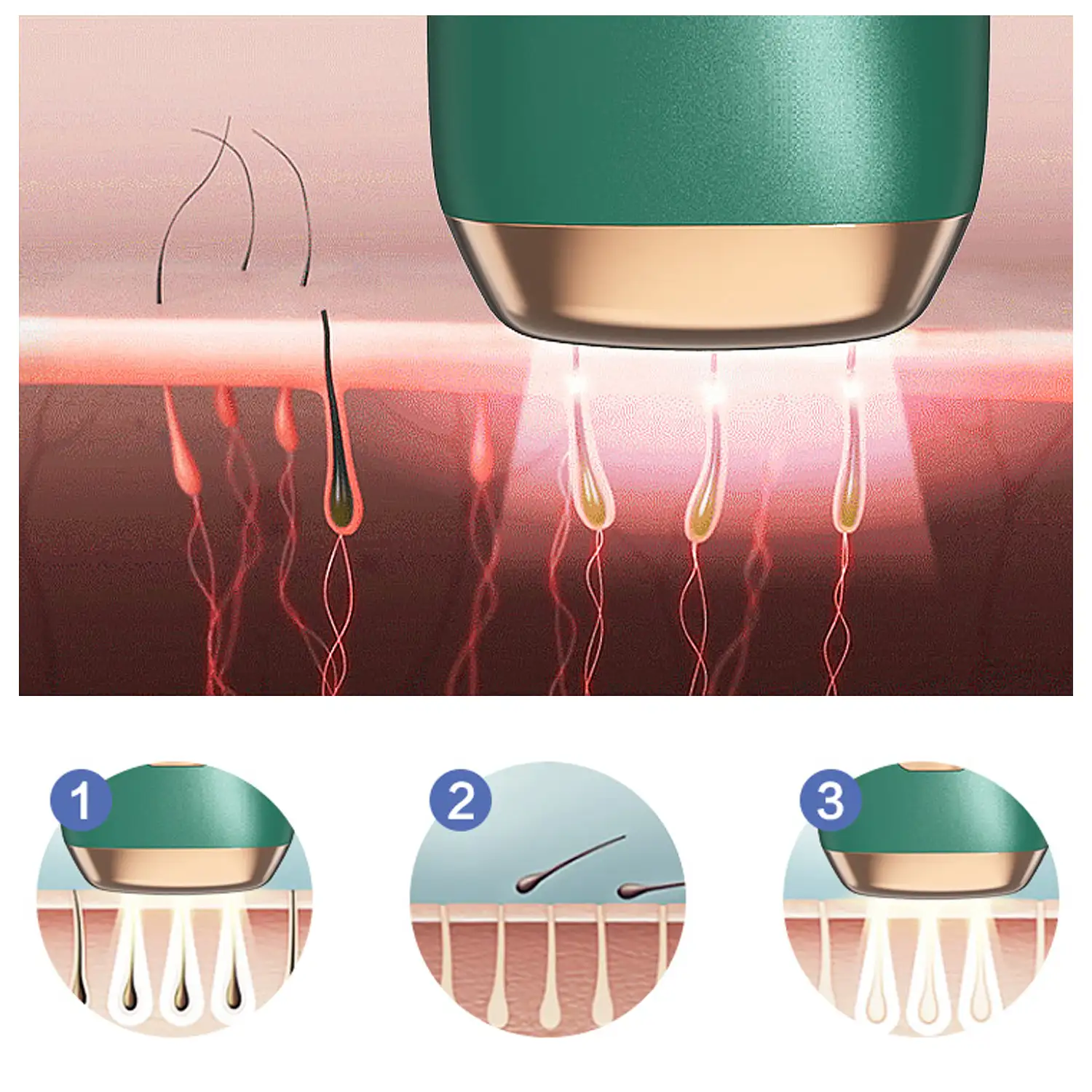 T4 Depiladora IPL de luz pulsada. 5 grados de intensidad,luz contínua alta intensidad 999.999 pulsos.