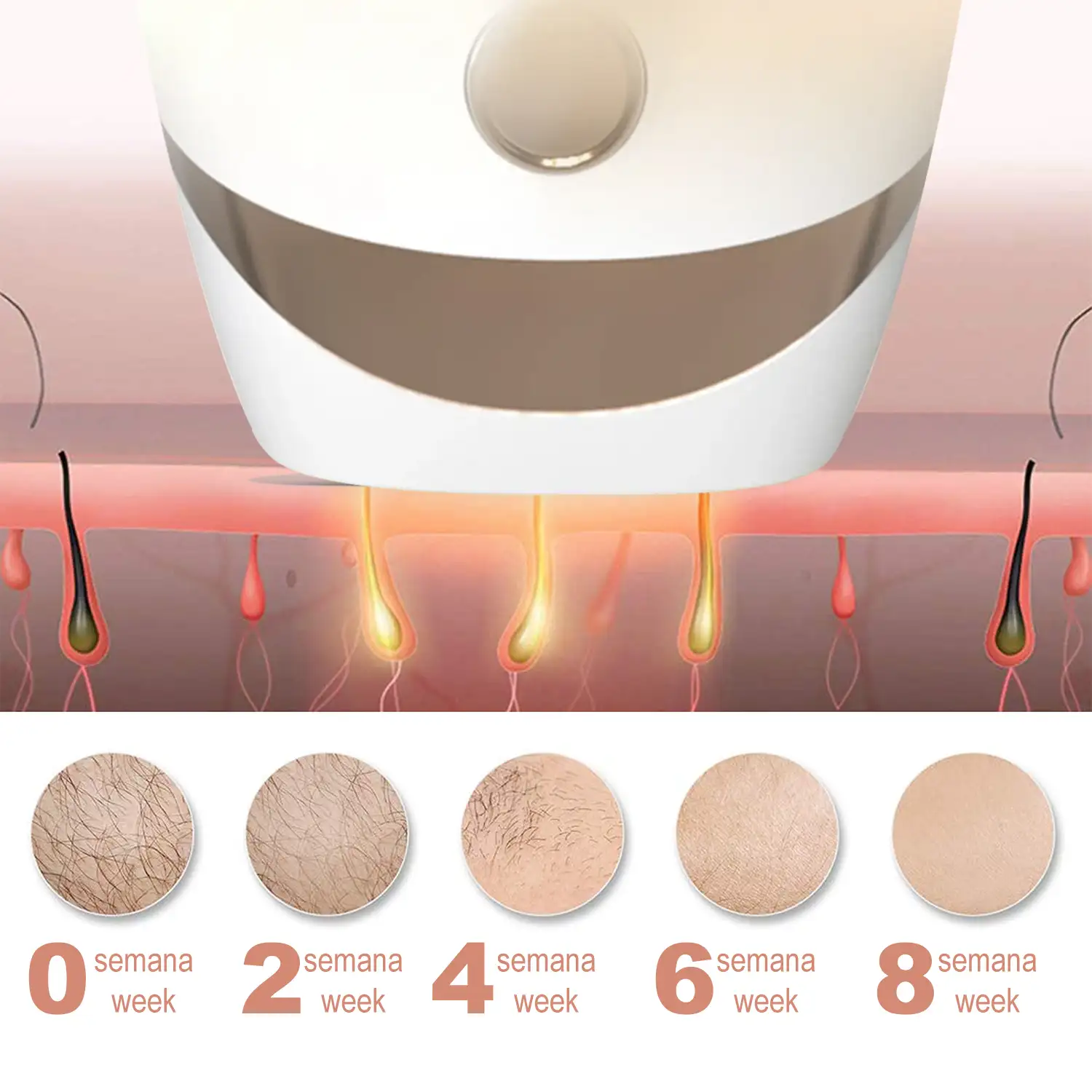 T20 Depiladora IPL de luz pulsada. 5 niveles de intensidad. Display digital.