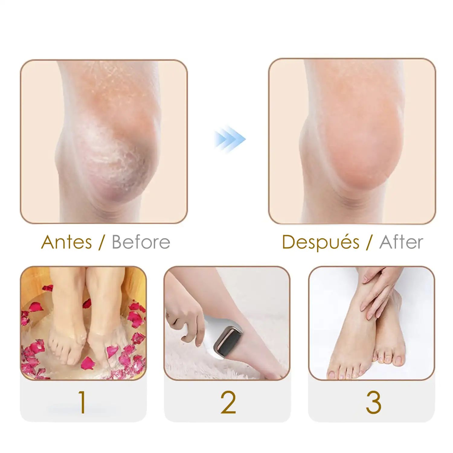 Lima electrónica para pies, pedicura avanzada.