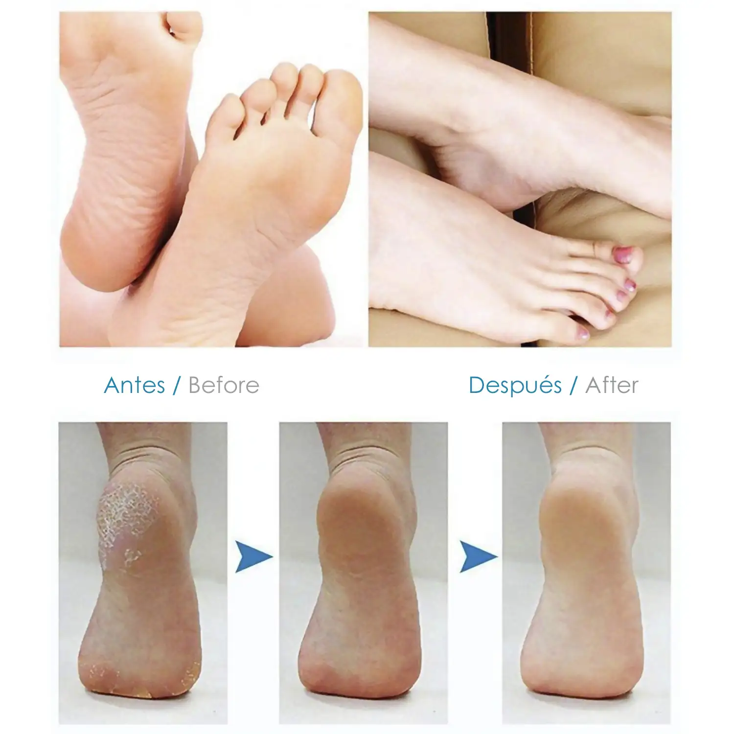 Lima electrónica para pies, pedicura avanzada.