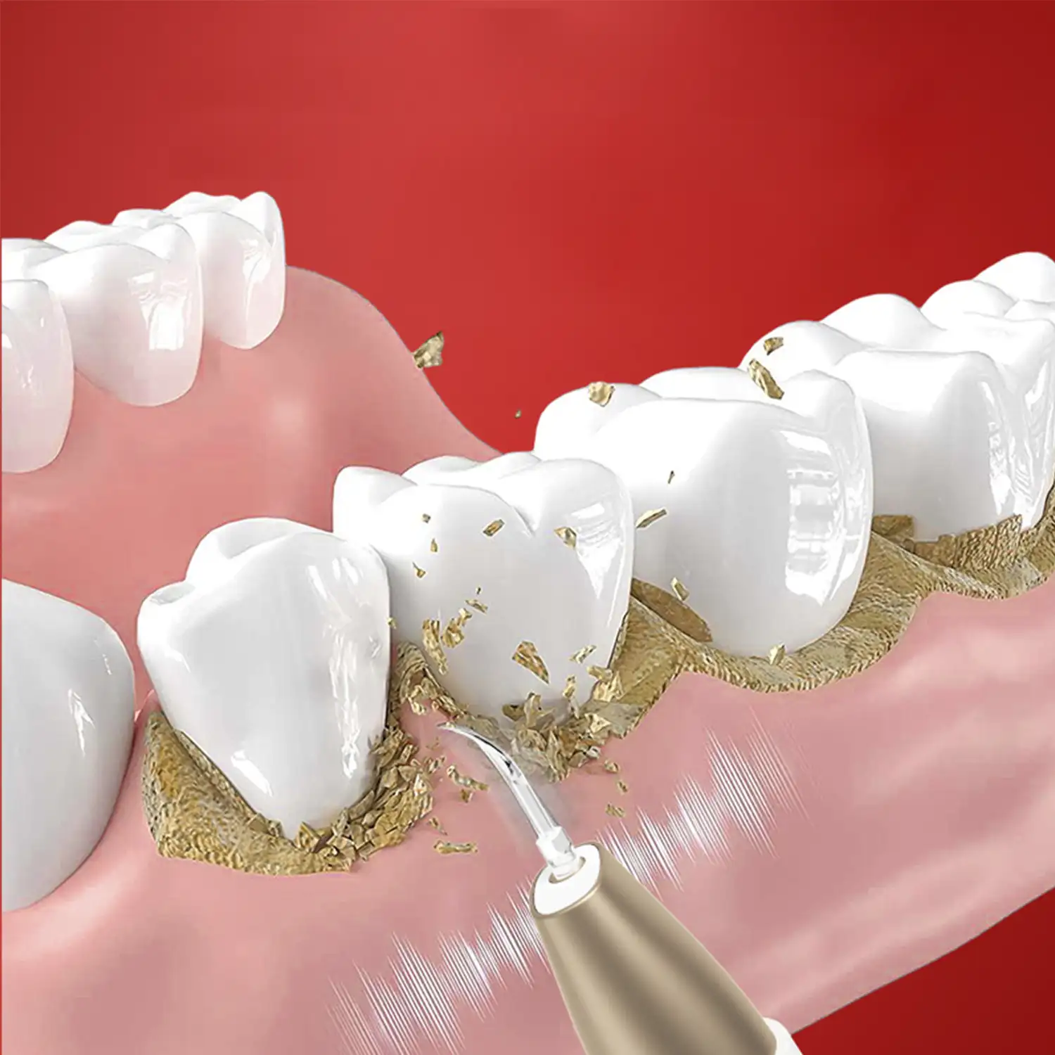 Escarificador dental ultrasónico. Base de carga, 2 cabezales incluidos. 5 intensidades.