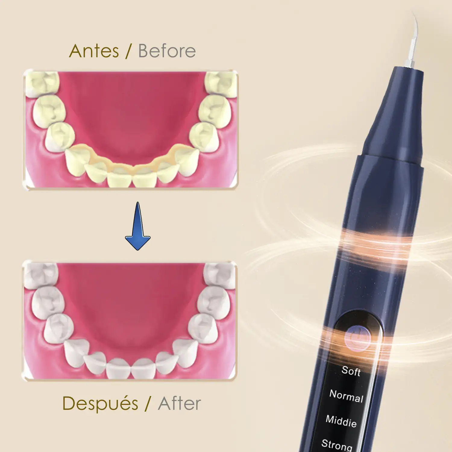 Escarificador dental ultrasónico. Base de carga, 2 cabezales incluidos. 5 intensidades.