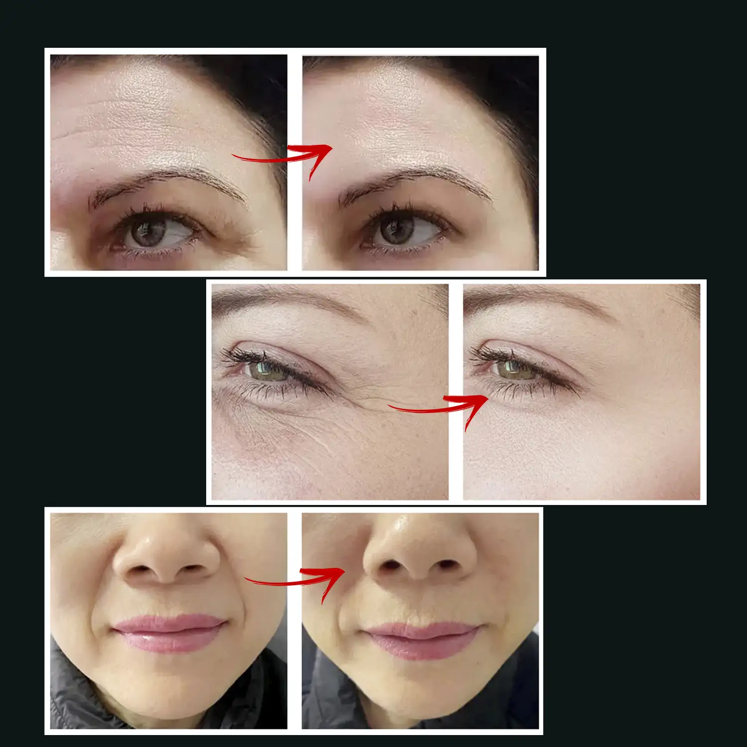 Instrumento de belleza facial. EMS, tratamiento de luz LED de 3 colores, WAV y VR. Tensa y rejuvence la piel.