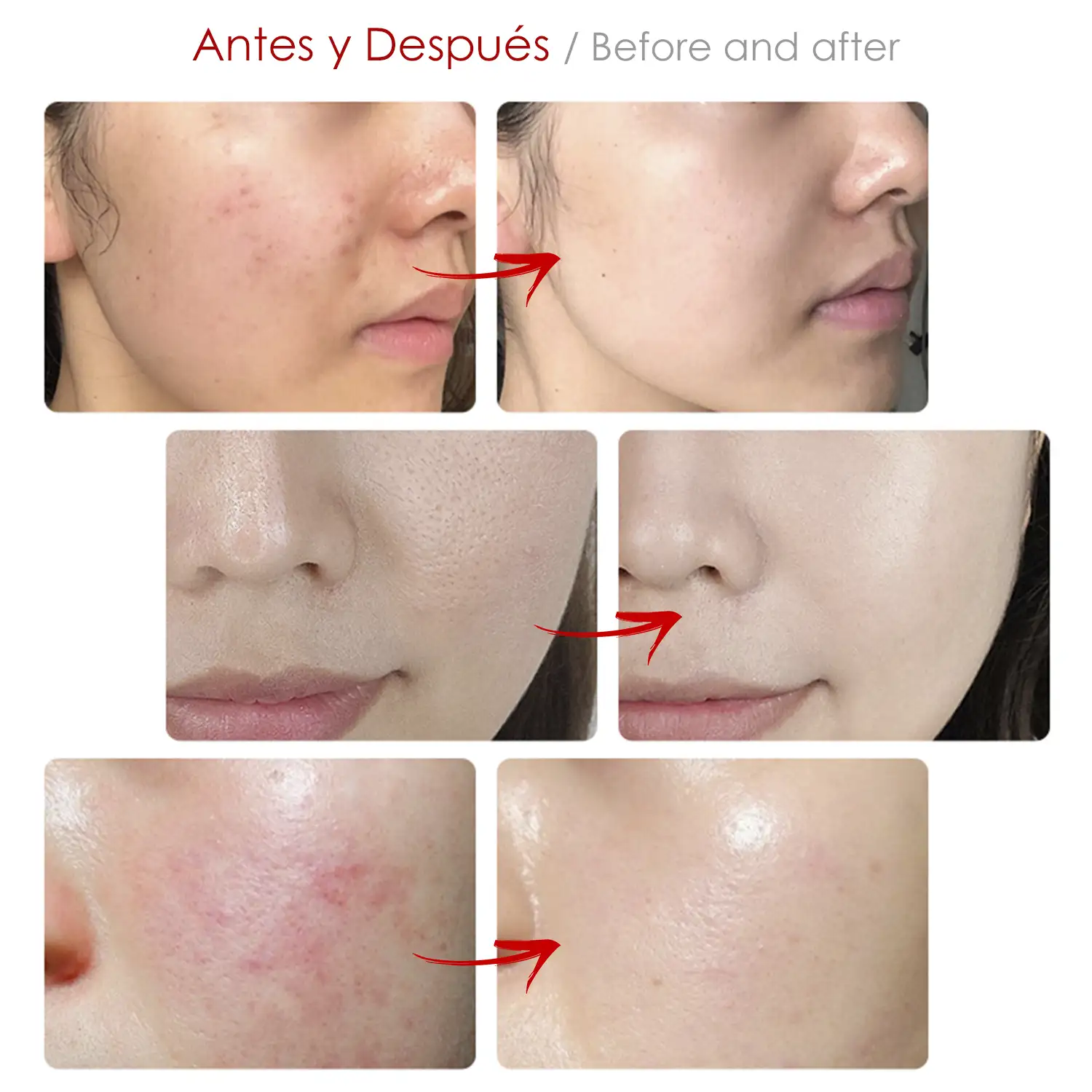 Máscara de tratamientos de la piel por luz. Cuidado facial, anti edad, rejuvenecimiento de la piel.