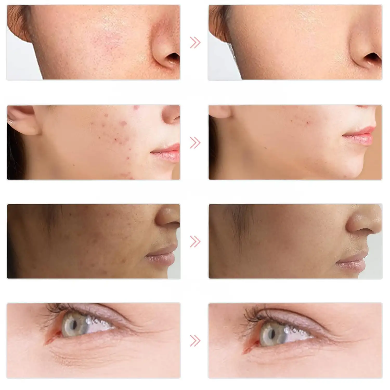 Máscara LED fotónica. Tratamiento de luz 7 colores. Cuidado facial, anti edad, rejuvenecimiento de la piel.